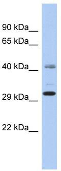 WB Suggested Anti-ARL14EPAntibody Titration: 0.2-1 ug/ml; ELISA Titer: 1: 1562500; Positive Control: OVCAR-3 cell lysate
