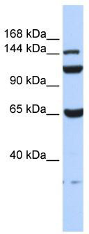 WB Suggested Anti-EFCAB13 Antibody Titration: 0.2-1 ug/ml; ELISA Titer: 1: 1562500; Positive Control: 293T cell lysate