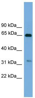 WB Suggested Anti-UBXN10 Antibody Titration: 0.2-1 ug/ml; Positive Control: 293T cell lysate