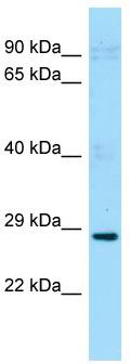 Gel: 8%SDS-PAGE<br>Lysate: 40 μg<br>Lane 1-5: Hela cells<br>A431 cells<br>mouse brain tissue<br>Mouse liver tissue<br>mouse pancreas tissue<br>Primary antibody: TA369005 (ENO1 Antibody) at dilution 1/500<br>Secondary antibody: Goat anti rabbit IgG at 1/8000 dilution<br>Exposure time: 10 seconds