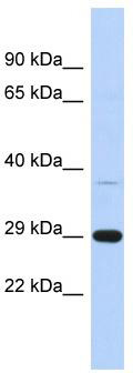 WB Suggested Anti-C1orf74 Antibody Titration: 0.2-1 ug/ml; ELISA Titer: 1: 312500; Positive Control: Human brain