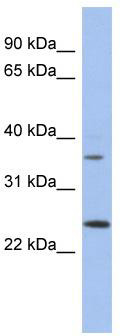 WB Suggested Anti-WBP2NL Antibody Titration: 0.2-1 ug/ml; ELISA Titer: 1: 312500; Positive Control: Human Placenta