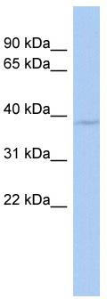 WB Suggested Anti-WBP2NL Antibody Titration: 0.2-1 ug/ml; ELISA Titer: 1: 312500; Positive Control: Human Stomach