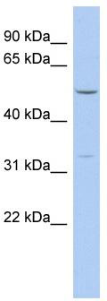 WB Suggested Anti-FBXO15 Antibody Titration: 0.2-1 ug/ml; ELISA Titer: 1: 1562500; Positive Control: OVCAR-3 cell lysate