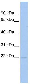 WB Suggested Anti-RWDD4A Antibody Titration: 0.2-1 ug/ml; ELISA Titer: 1: 1562500; Positive Control: Human Intestine