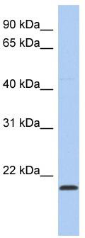 WB Suggested Anti-RWDD4A Antibody Titration: 0.2-1 ug/ml; ELISA Titer: 1: 312500; Positive Control: SH-SYSY cell lysate