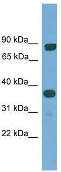 WB Suggested Anti-KHDRBS2 Antibody Titration: 0.2-1 ug/ml; ELISA Titer: 1: 312500; Positive Control: Human Lung