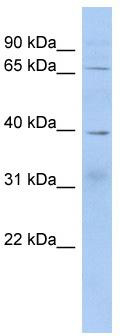 WB Suggested Anti-KHDRBS2 Antibody Titration: 0.2-1 ug/ml; ELISA Titer: 1: 62500; Positive Control: Human Liver