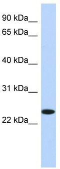 WB Suggested Anti-NKAIN4 Antibody Titration: 0.2-1 ug/ml; ELISA Titer: 1: 62500; Positive Control: HepG2 cell lysate