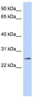 WB Suggested Anti-NKAIN4 Antibody Titration: 0.2-1 ug/ml; ELISA Titer: 1: 1562500; Positive Control: MCF7 cell lysate