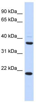 WB Suggested Anti-TMEM74 Antibody Titration: 0.2-1 ug/ml; ELISA Titer: 1: 62500; Positive Control: Human heart