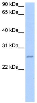 WB Suggested Anti-SBSPON Antibody Titration: 0.2-1 ug/ml; Positive Control: Jurkat cell lysate