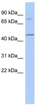 WB Suggested Anti-FBXO39 Antibody Titration: 0.2-1 ug/ml; ELISA Titer: 1: 1562500; Positive Control: 721_B cell lysate