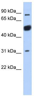 WB Suggested Anti-BEND2 Antibody Titration: 0.2-1 ug/ml; ELISA Titer: 1: 1562500; Positive Control: MCF7 cell lysate