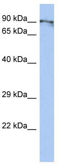 WB Suggested Anti-BEND2 Antibody Titration: 0.2-1 ug/ml; ELISA Titer: 1: 312500; Positive Control: HT1080 cell lysate