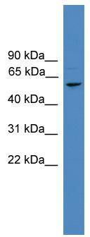 WB Suggested Anti-FBXL16 Antibody Titration: 0.2-1 ug/ml; ELISA Titer: 1: 1562500; Positive Control: COLO205 cell lysate