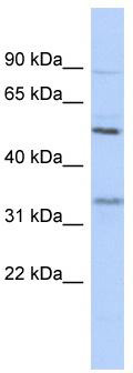 WB Suggested Anti-PRSS35 Antibody Titration: 0.2-1 ug/ml; ELISA Titer: 1: 62500; Positive Control: 721_B cell lysate