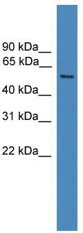 WB Suggested Anti-FAM71A Antibody Titration: 0.2-1 ug/ml; ELISA Titer: 1: 62500; Positive Control: Jurkat cell lysate