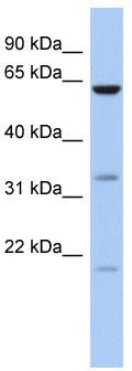 WB Suggested Anti-CPNE9 Antibody Titration: 0.2-1 ug/ml; ELISA Titer: 1: 62500; Positive Control: 721_B cell lysate