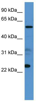 WB Suggested Anti-CPNE9 Antibody Titration: 0.2-1 ug/ml; ELISA Titer: 1: 1562500; Positive Control: 721_B cell lysate