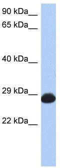Gel: 8%SDS-PAGE<br>Lysate: 20 μg<br>Lane: Human cerebella tissue lysate<br>Primary antibody: TA367978 (CADM2 Antibody) at dilution 1/2000<br>Secondary antibody: Goat anti rabbit IgG at 1/8000 dilution<br>Exposure time: 1 second