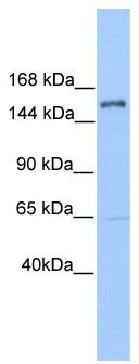 WB Suggested Anti-PLEKHH2 Antibody Titration: 1 ug/ml; Positive Control: Jurkat cell lysate