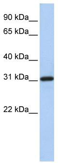 WB Suggested Anti-FBXO16 Antibody Titration: 0.2-1 ug/ml; Positive Control: Hela cell lysate