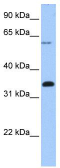 WB Suggested Anti-FBXO16 Antibody Titration: 0.2-1 ug/ml; Positive Control: Human brain