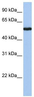 WB Suggested Anti-SLC38A9 Antibody Titration: 0.2-1 ug/ml; Positive Control: Jurkat cell lysate