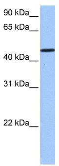 WB Suggested Anti-SAMD14 Antibody Titration: 0.2-1 ug/ml; Positive Control: Jurkat cell lysate