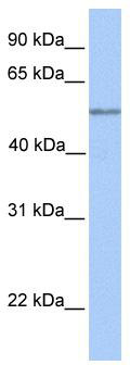 WB Suggested Anti-C17orf74 Antibody Titration: 0.2-1 ug/ml; Positive Control: Hela cell lysate