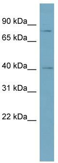 WB Suggested Anti-SPPL2C Antibody Titration: 0.2-1 ug/ml; ELISA Titer: 1: 62500; Positive Control: Human Thymus