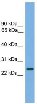 WB Suggested Anti-CHMP4B Antibody Titration: 0.2-1 ug/ml; Positive Control: Jurkat cell lysate