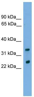 WB Suggested Anti-CHMP4B Antibody Titration: 0.2-1 ug/ml; Positive Control: THP-1 cell lysate