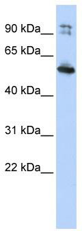 WB Suggested Anti-DNAAF1Antibody Titration: 0.2-1 ug/ml; ELISA Titer: 1: 1562500; Positive Control: HepG2 cell lysate