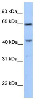WB Suggested Anti-CCDC60 Antibody Titration: 0.2-1 ug/ml; Positive Control: MCF7 cell lysate