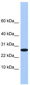 WB Suggested Anti-FAM101A Antibody Titration: 0.2-1 ug/ml; Positive Control: 721_B cell lysate