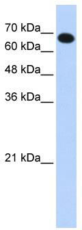 WB Suggested Anti-CCDC38 Antibody Titration: 0.2-1 ug/ml; ELISA Titer: 1: 312500; Positive Control: Transfected 293T