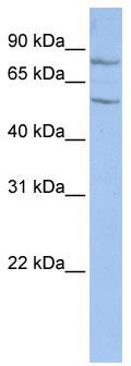 WB Suggested Anti-TCTE1 Antibody Titration: 0.2-1 ug/ml; ELISA Titer: 1: 312500; Positive Control: HepG2 cell lysate