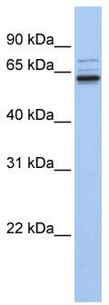 WB Suggested Anti-ARHGEF25Antibody Titration: 0.2-1 ug/ml; ELISA Titer: 1: 312500; Positive Control: Human brain