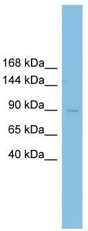 WB Suggested Anti-XRRA1 Antibody Titration: 0.2-1 ug/ml; ELISA Titer: 1: 1562500; Positive Control: HepG2 cell lysate