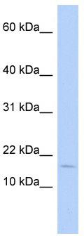 WB Suggested Anti-ISCA2 Antibody Titration: 0.2-1 ug/ml; ELISA Titer: 1: 1562500; Positive Control: Human Thymus