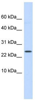 WB Suggested Anti-LYPD6 Antibody Titration: 0.2-1 ug/ml; ELISA Titer: 1: 312500; Positive Control: Human Small Intestine