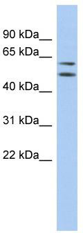 WB Suggested Anti-ABHD15 Antibody Titration: 0.2-1 ug/ml; ELISA Titer: 1: 312500; Positive Control: 721_B cell lysate