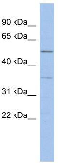 WB Suggested Anti-ABHD15 Antibody Titration: 0.2-1 ug/ml; ELISA Titer: 1: 312500; Positive Control: ACHN cell lysate