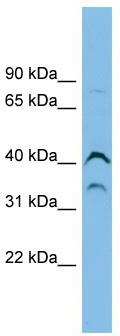 WB Suggested Anti-ASB7 Antibody Titration: 0.2-1 ug/ml; ELISA Titer: 1: 312500; Positive Control: PANC1 cell lysate