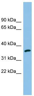 WB Suggested Anti-AKR1C2 Antibody Titration: 0.2-1 ug/ml; ELISA Titer: 1: 1562500; Positive Control: MCF7 cell lysate