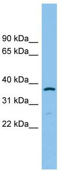 WB Suggested Anti-AKR1C2 Antibody Titration: 0.2-1 ug/ml; ELISA Titer: 1: 312500; Positive Control: MCF7 cell lysate