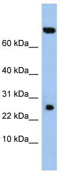 WB Suggested Anti-ZSWIM3 Antibody Titration: 0.2-1 ug/ml; ELISA Titer: 1: 312500; Positive Control: DU145 cell lysate