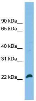 WB Suggested Anti-SPATA24 Antibody Titration: 0.2-1 ug/ml; ELISA Titer: 1: 312500; Positive Control: Jurkat cell lysate